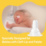 Baby Cleft Lip/Palate Bottle with 2 Nipples, 8.11 Oz-2